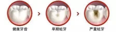 牙齿坏了需要补牙，过程是怎样的