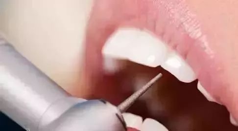 牙齿坏了需要补牙，过程是怎样的