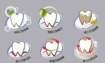 【周茹讲述】 洗牙到底安不安全