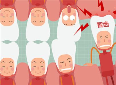 上海拔智齿一颗牙多少钱
