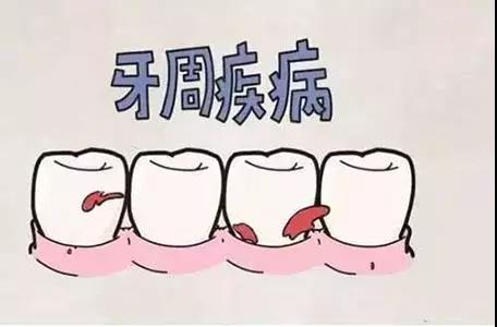 吃苹果或者刷牙时牙龈出血怎么回事？怎么办？