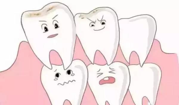 儿童牙齿矫正什么年龄合适？12岁前必须处理的12种牙颌畸形