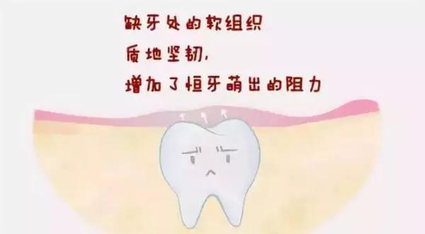 儿童牙齿矫正什么年龄合适？12岁前必须处理的12种牙颌畸形