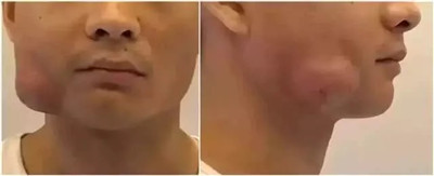 牙生病了一拖再拖？越拖你花的钱就越多
