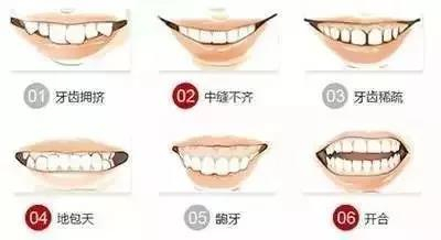 <牙医>比起名牌包包等奢侈品，牙齿矫正的价格算是「平价」了