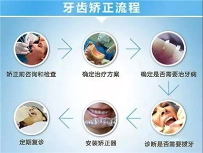 <牙医>比起名牌包包等奢侈品，牙齿矫正的价格算是「平价」了