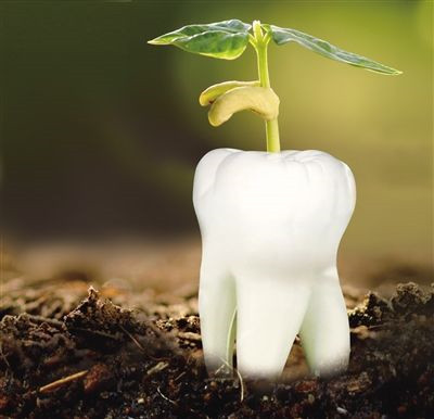【种植牙昂贵的秘密】原来受欢迎的是这三种植体