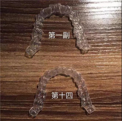 【昌平牙齿矫正】匠心精神的矫正医师，才能达到近乎完美的牙齿矫正效果