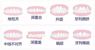 【昌平牙齿矫正】学生党寒假牙齿矫正三大理由 不服不行