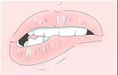 【昌平儿童口腔】影响孩子牙齿发育和颜值的八大坏习惯 宝妈要重视了