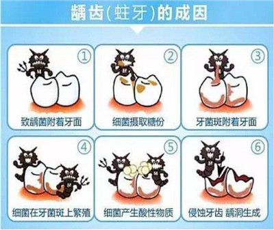 【昌平补牙】昌平补牙多少钱？同样是补牙为啥价格差异这么大？