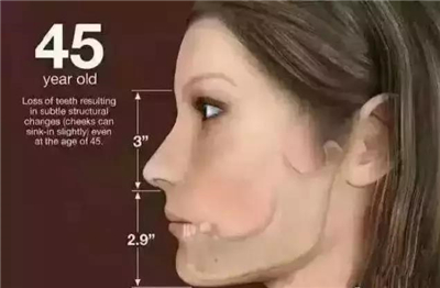 英国牙科研究：富人和穷人之间差了8颗牙 !