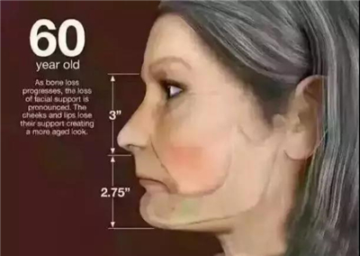 英国牙科研究：富人和穷人之间差了8颗牙 !