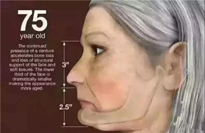 英国牙科研究：富人和穷人之间差了8颗牙 !