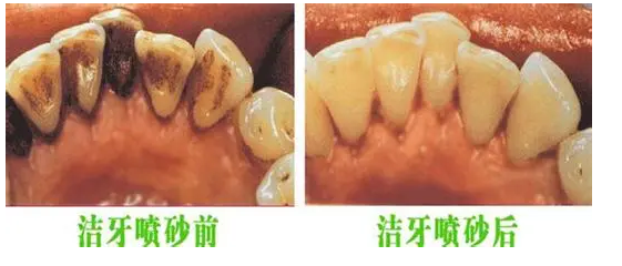 xiyapensha.png